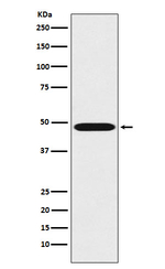 Renin Recombinant Rabbit Monoclonal Antibody (K01_4L17)