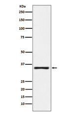 Kallikrein 2 Recombinant Rabbit Monoclonal Antibody (K01_4L18)