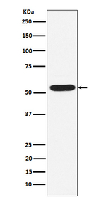 PIAS2 Recombinant Rabbit Monoclonal Antibody (K01_4L19)