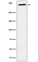 LPA Recombinant Rabbit Monoclonal Antibody (K01_4L20)