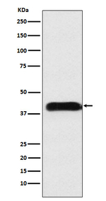 M6PR Recombinant Rabbit Monoclonal Antibody (K01_4L21)