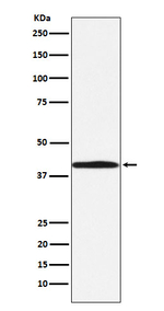 ABO Recombinant Rabbit Monoclonal Antibody (K01_4L23)