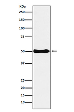 CSK Recombinant Rabbit Monoclonal Antibody (K01_4L24)