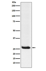 Hippocalcin Antibody in Western Blot (WB)
