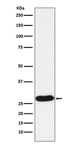 PR3 Recombinant Rabbit Monoclonal Antibody (K01_4L31)