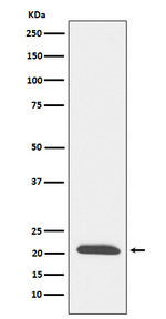Dynactin 3 Recombinant Rabbit Monoclonal Antibody (K01_4L34)