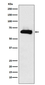 DPYSL3 Antibody in Western Blot (WB)