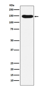 Desmoglein 3 Recombinant Rabbit Monoclonal Antibody (K01_4L43)