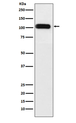SERCA1 ATPase Antibody in Western Blot (WB)