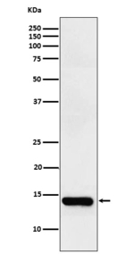 FABP2 Recombinant Rabbit Monoclonal Antibody (K01_4L49)
