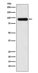 ACVR2A Recombinant Rabbit Monoclonal Antibody (K01_4L53)