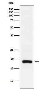 ARF5 Recombinant Rabbit Monoclonal Antibody (K01_4L70)