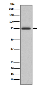 ABI2 Recombinant Rabbit Monoclonal Antibody (K01_4L72)