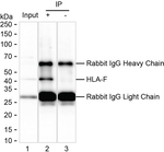 HLA-F Antibody in Immunoprecipitation (IP)