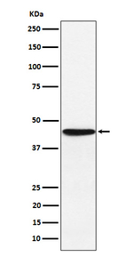 HLA-F Recombinant Rabbit Monoclonal Antibody (K01_4L74)