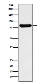 GUSB Recombinant Rabbit Monoclonal Antibody (K01_4L78)