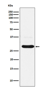 CHMP2B Antibody in Western Blot (WB)