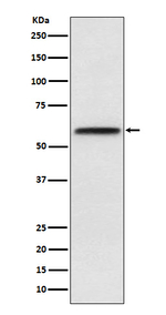 LCAT Recombinant Rabbit Monoclonal Antibody (K01_4L83)