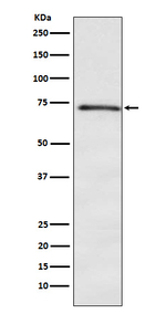 DOK1 Recombinant Rabbit Monoclonal Antibody (K01_4L85)