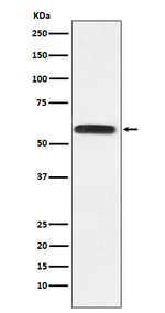 LGI1 Recombinant Rabbit Monoclonal Antibody (K01_4L93)