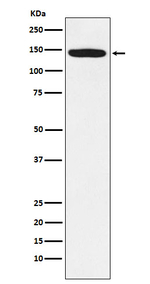 HTATSF1 Antibody in Western Blot (WB)