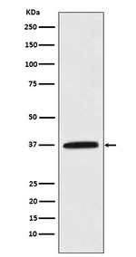 Kallikrein 5 Recombinant Rabbit Monoclonal Antibody (K01_4L97)