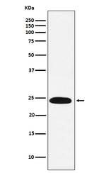 VPS28 Recombinant Rabbit Monoclonal Antibody (K01_4M01)