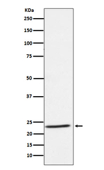 IL-32 Recombinant Rabbit Monoclonal Antibody (K01_4M08)