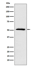 ETV6 Recombinant Rabbit Monoclonal Antibody (K01_4M11)