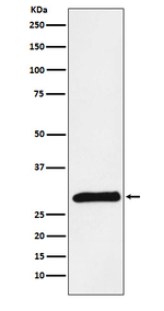 Trypsin 2 Recombinant Rabbit Monoclonal Antibody (K01_4M19)