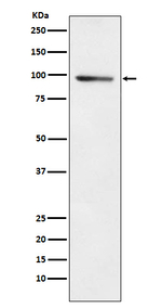 PDE4B Recombinant Rabbit Monoclonal Antibody (K01_4M20)