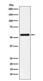 NLK Recombinant Rabbit Monoclonal Antibody (K01_4M23)