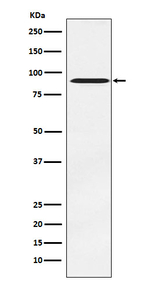 ATRIP Recombinant Rabbit Monoclonal Antibody (K01_4M31)