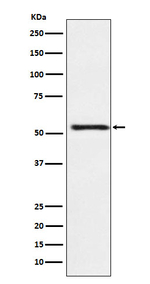 ATP4B Recombinant Rabbit Monoclonal Antibody (K01_4M34)