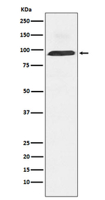 Dynamin 3 Recombinant Rabbit Monoclonal Antibody (K01_4M37)