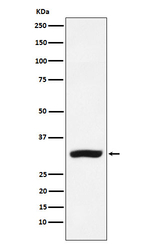CBR1 Recombinant Rabbit Monoclonal Antibody (K01_4M41)