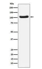 PDE2A Recombinant Rabbit Monoclonal Antibody (K01_4M42)