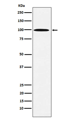 gamma Adaptin Recombinant Rabbit Monoclonal Antibody (K01_4M44)