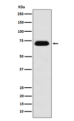 NUP62 Recombinant Rabbit Monoclonal Antibody (K01_4M45)