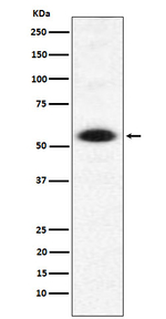 DMAP1 Antibody in Western Blot (WB)