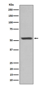 Cytokeratin 12 Recombinant Rabbit Monoclonal Antibody (K01_4M49)