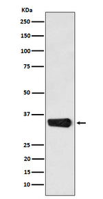 MBD3 Recombinant Rabbit Monoclonal Antibody (K01_4M50)