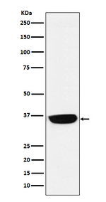 PHOX2B Recombinant Rabbit Monoclonal Antibody (K01_4M51)