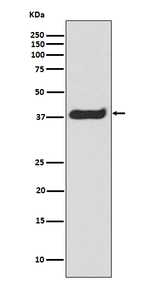 Phospho-LAT (Tyr191) Recombinant Rabbit Monoclonal Antibody (K01_4M54)