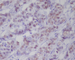 Phospho-p53 (Ser392) Recombinant Rabbit Monoclonal Antibody (K01_4M61)