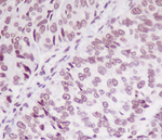 Phospho-SMC1 (Ser957) Recombinant Rabbit Monoclonal Antibody (K01_4M71)