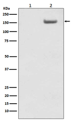 Phospho-SMC1 (Ser957) Antibody in Western Blot (WB)