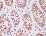 Phospho-SIRT1 (Ser47) Recombinant Rabbit Monoclonal Antibody (K01_4M72)
