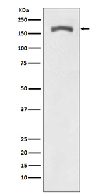 Phospho-PDGF Receptor beta (Tyr740) Antibody in Western Blot (WB)
