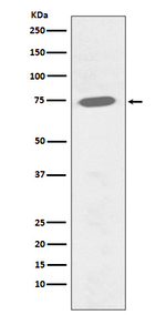 Phospho-Btk (Tyr551) Recombinant Rabbit Monoclonal Antibody (K01_4M77)